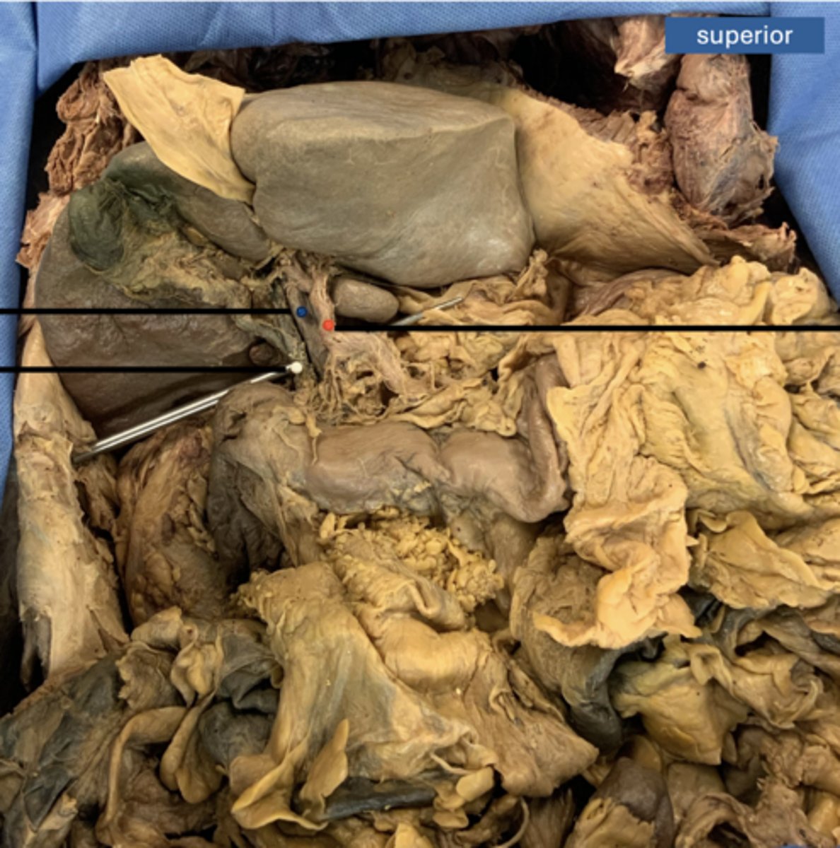 <p>artery</p>