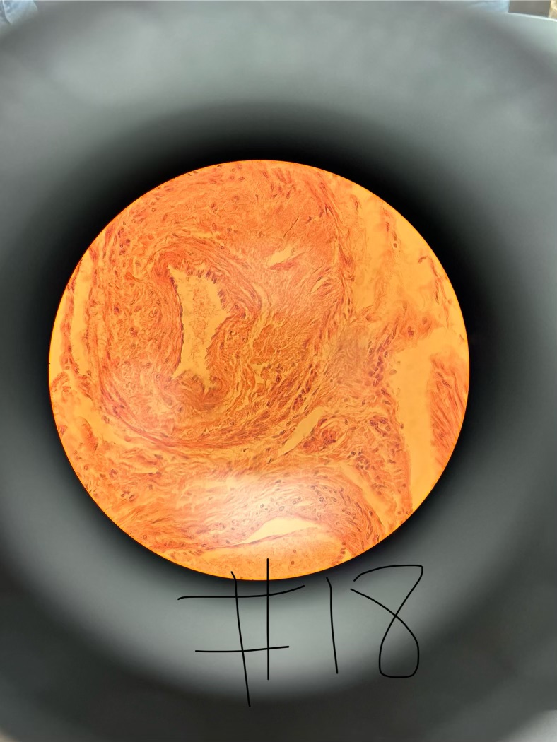 term image