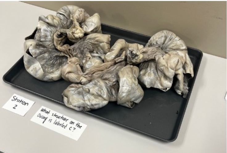 <p>What structure is the on the ovary is the arrow pointing to? </p>