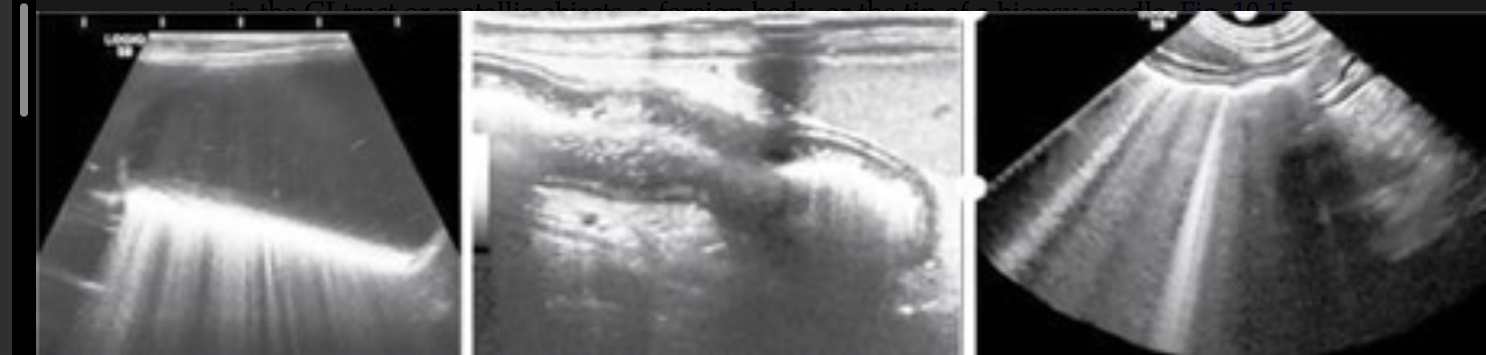 <ul><li><p>type of reverberation artifact seen with gas interfaces </p></li><li><p>smaller width strong lines produced </p></li><li><p>air pockets in GI tract or metallic objects, a foreign body, or tip of a biopsy needle</p></li></ul><p></p>
