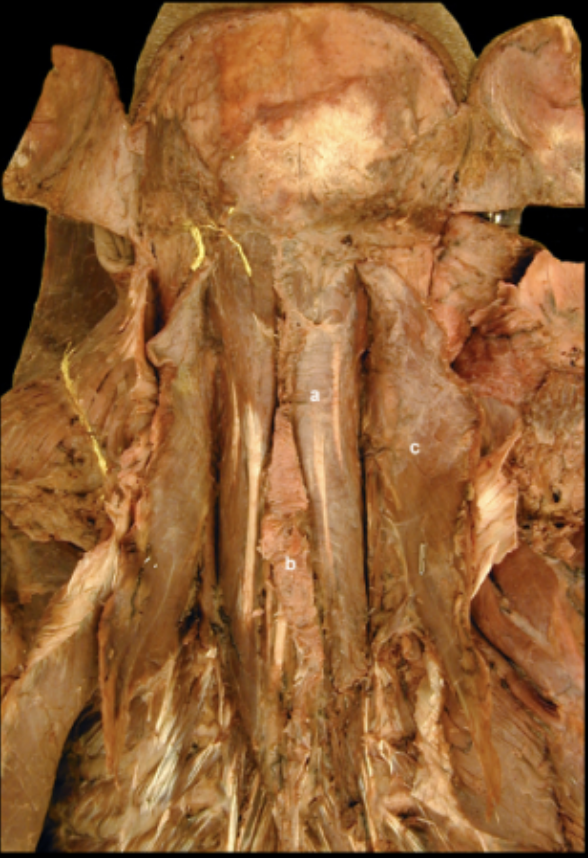 <p>Semispinalis m. </p>