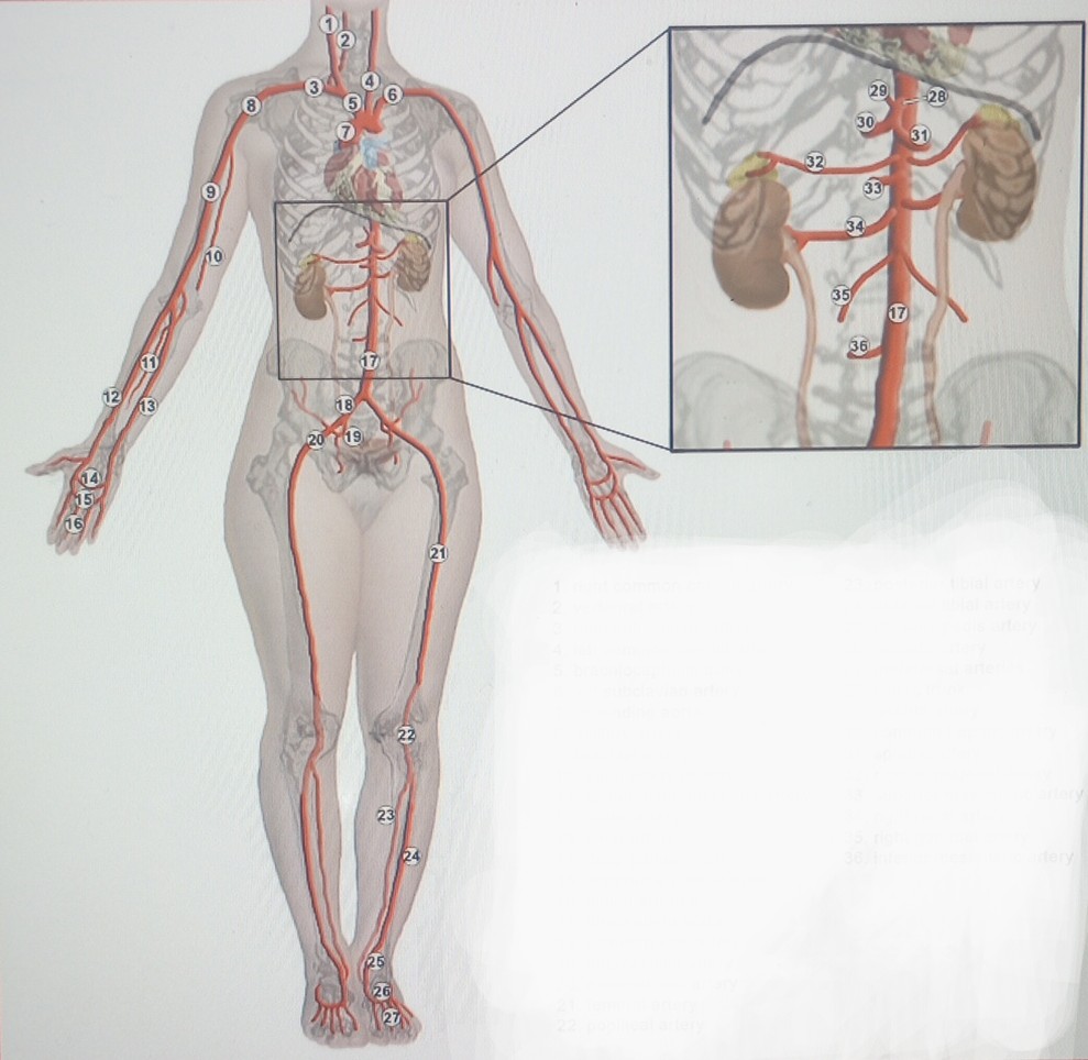  right renal artery