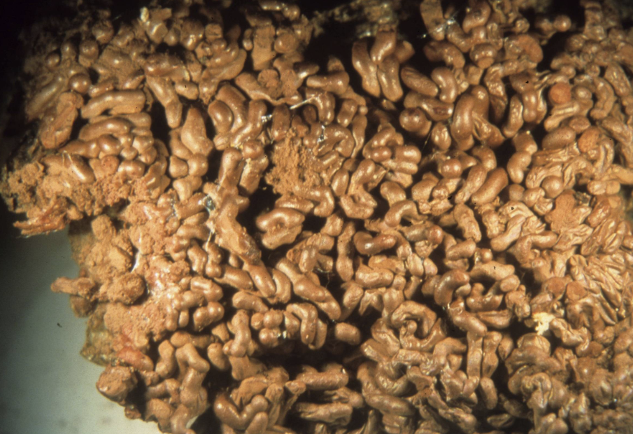 <p>Arcyria stipata</p>