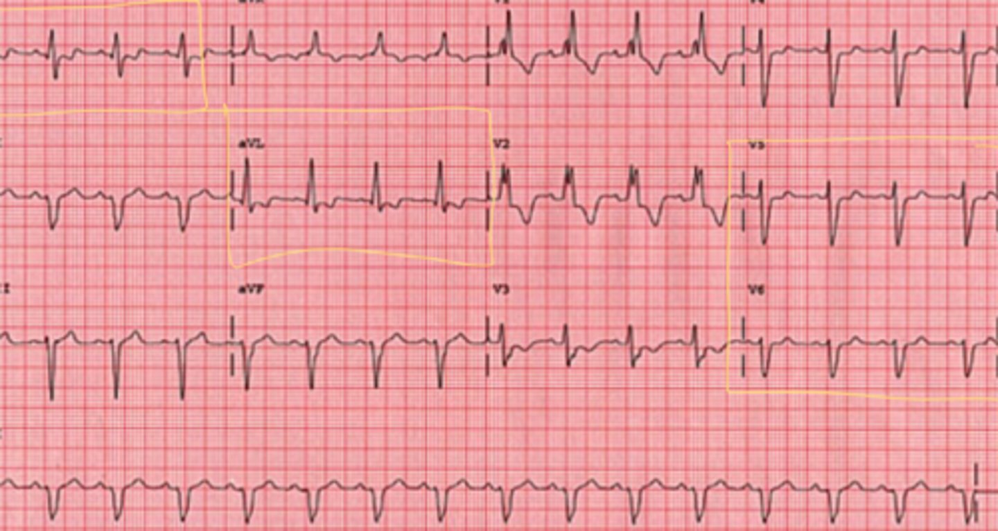 <p>What are the findings</p>