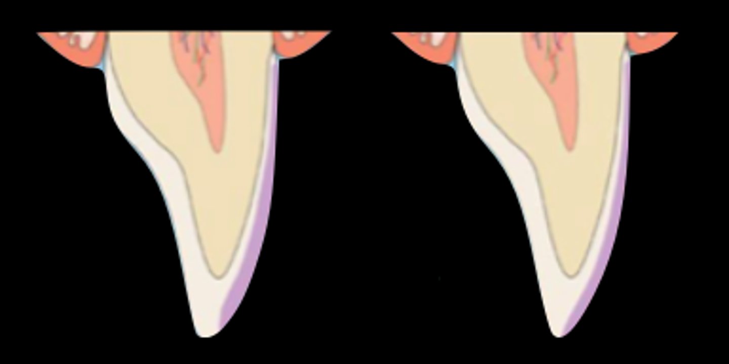 <p>What type of incisal preparation?</p>