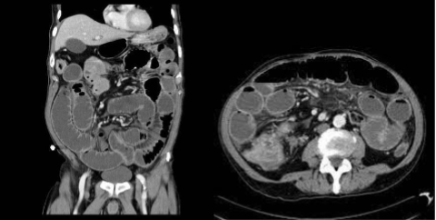 <p>What is this </p>