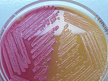 <p>Selective = G- bacteria, bile salts &amp; crystal violet</p><p>Differential = lactose fermentation, lactose &amp; neutral red </p><p>Pink color change if the bacteria can ferment sugar</p>