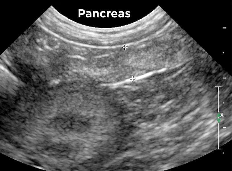 <p>Pancreas</p>