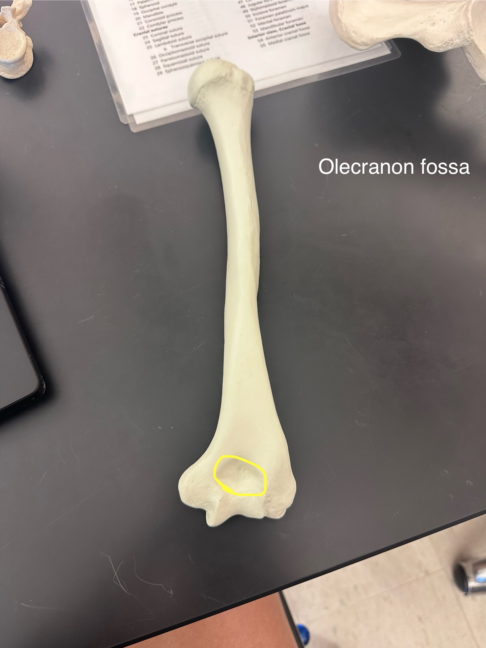 <p>Olecranon Fossa</p>