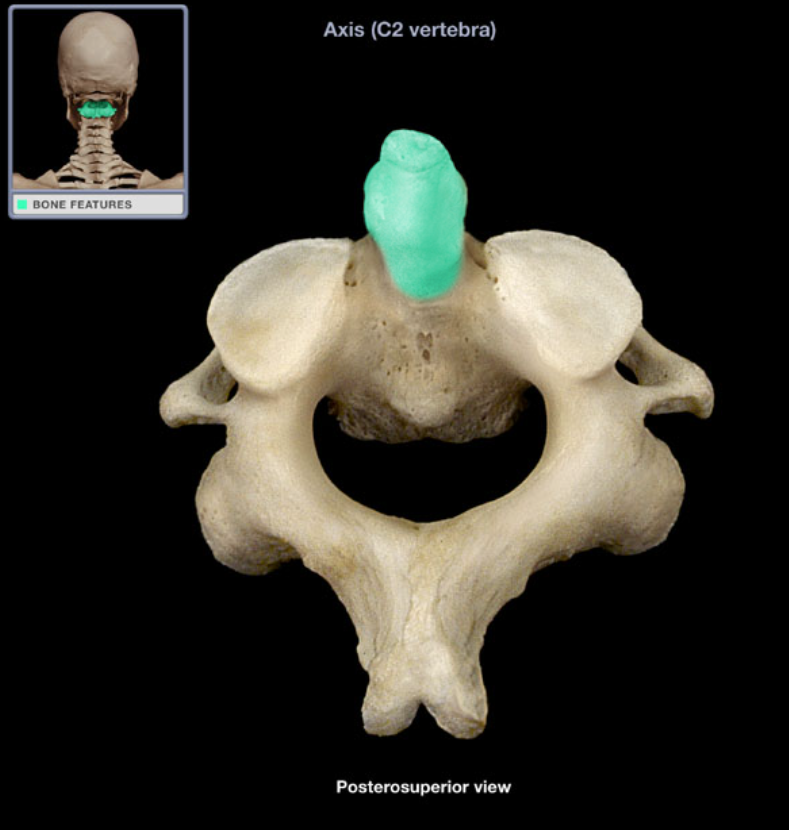 <ul><li><p>Location: Axis (C2 vertebra)</p></li><li><p>Description: Prominent, finger-like projection from superior aspect of body of axis (C2 vertebra)</p></li><li><p>Also known as: Odontoid process</p></li><li><p>Comment: Represents body of atlas (C1 vertebra), No other vertebra has a dens</p></li></ul><p></p>