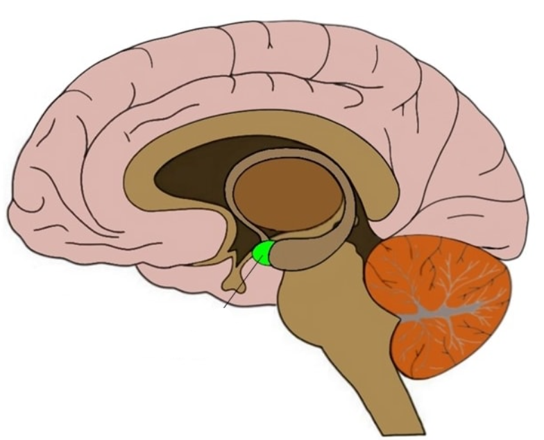 term image