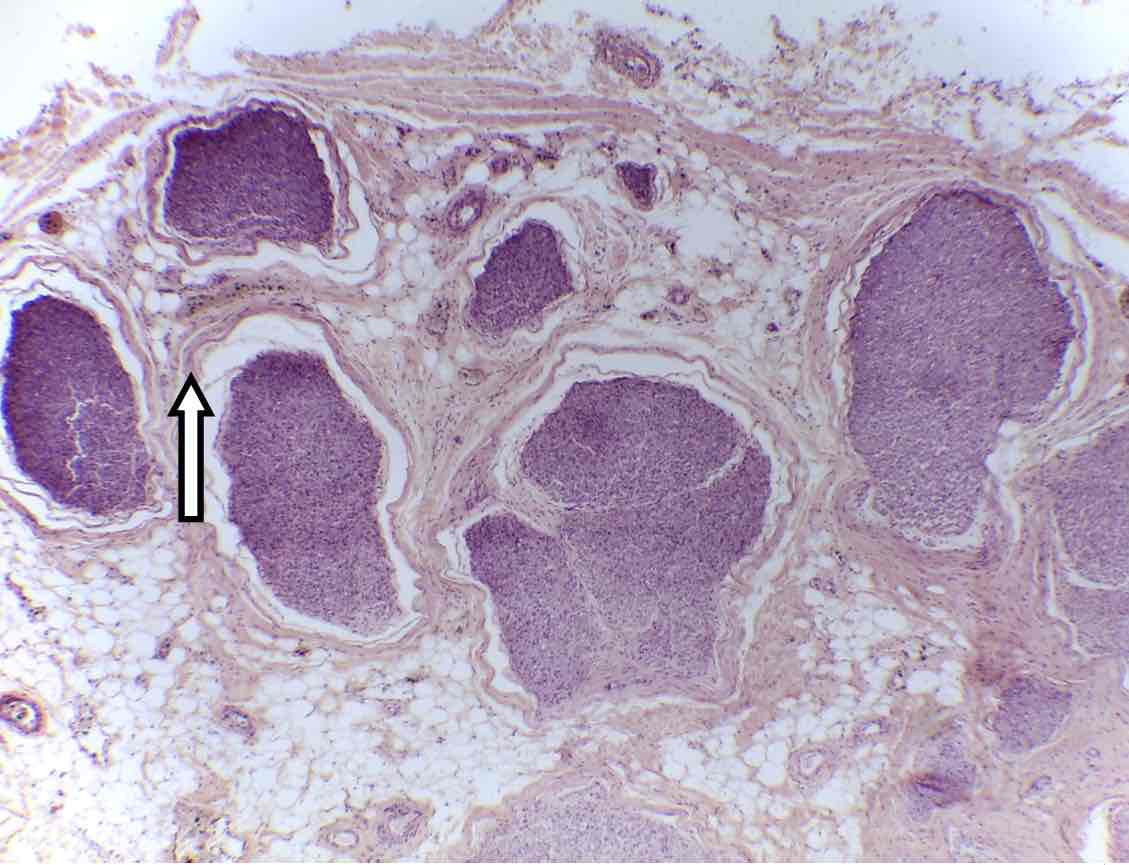 <p>name the connective tissue layer</p>