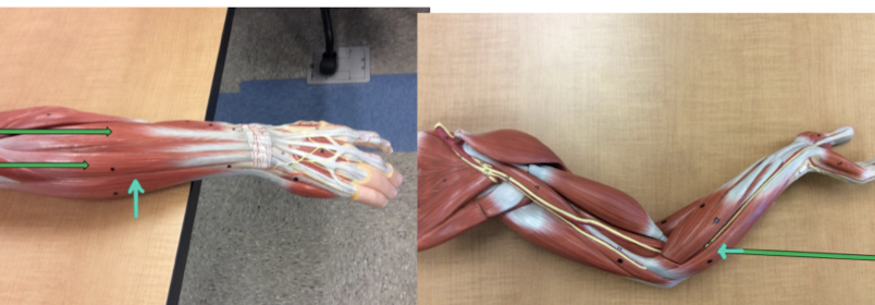 <p>Identify this muscle?</p>