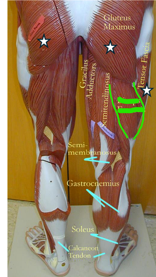 <ul><li><p>flexes the leg and extends the thigh </p></li></ul><p></p>