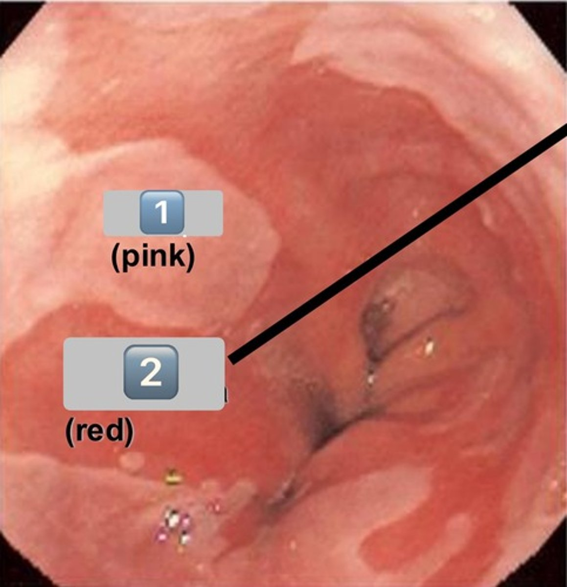 <p>what pathology?</p>