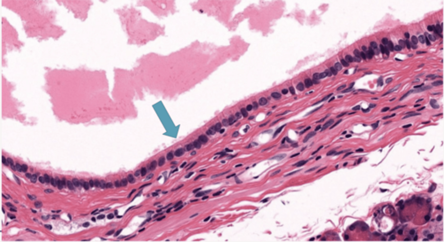 <p>Identify the type of epithelia</p>