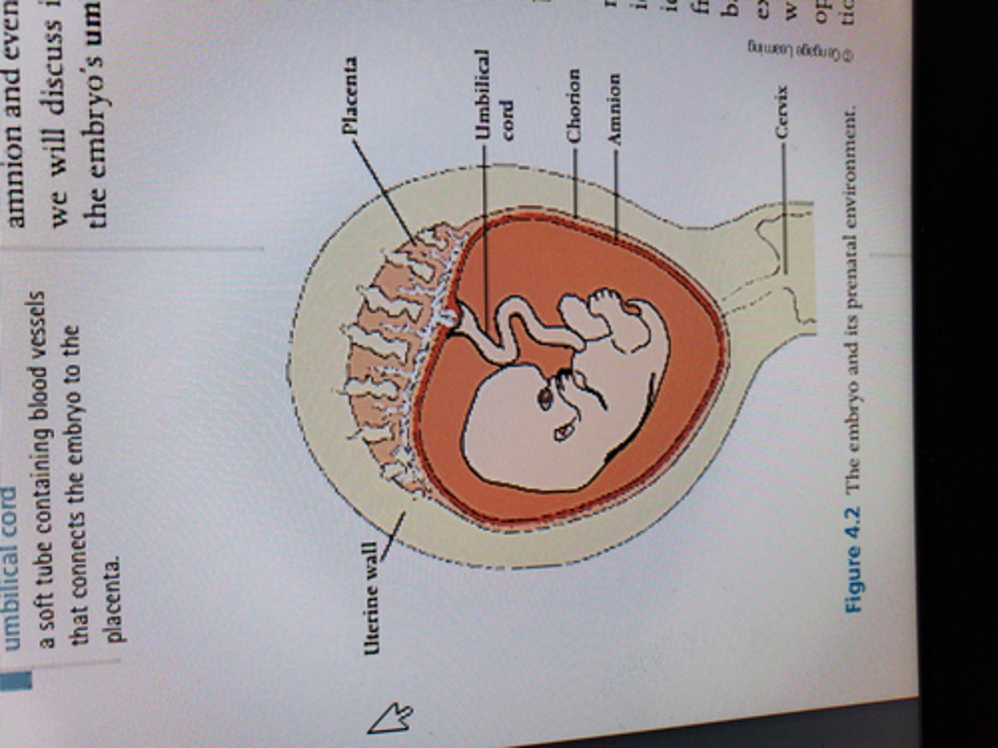<p>Innermost membranous sac surrounding the developing fetus</p><p>cushions</p>