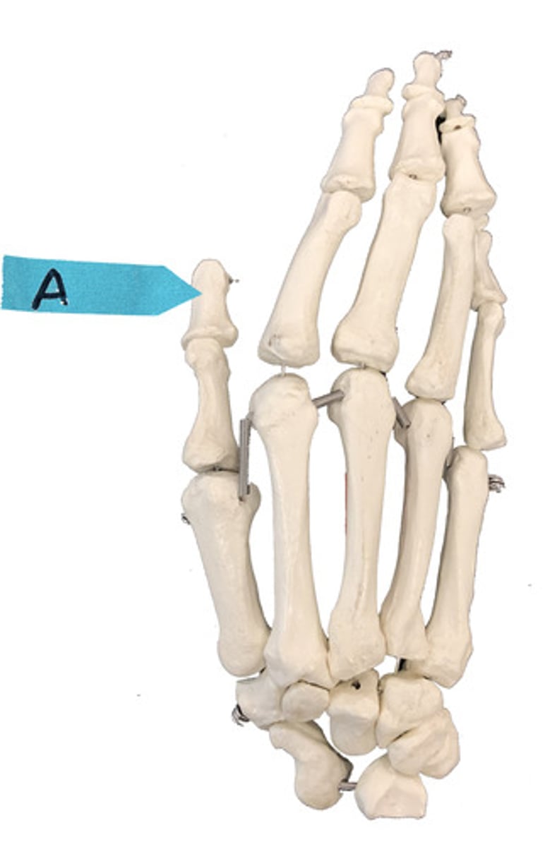 <p>Identify this bone (be specific).</p>