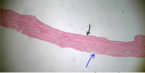 <p>specimen in field of view (&amp; position)</p><p>specific layer at tip of black arrow</p><p>specific layer at tip of blue arrow</p><p>space touching black arrow’s layer</p>