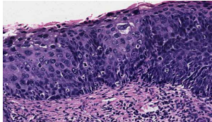 <p>identify ?</p><p>other types of Acquired Disordered Growth</p>