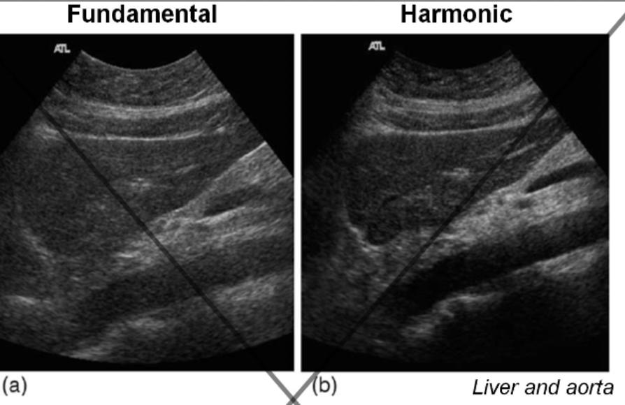 <p><strong>What is tissue harmonic imaging, and how does it benefit ultrasound imaging?</strong></p>