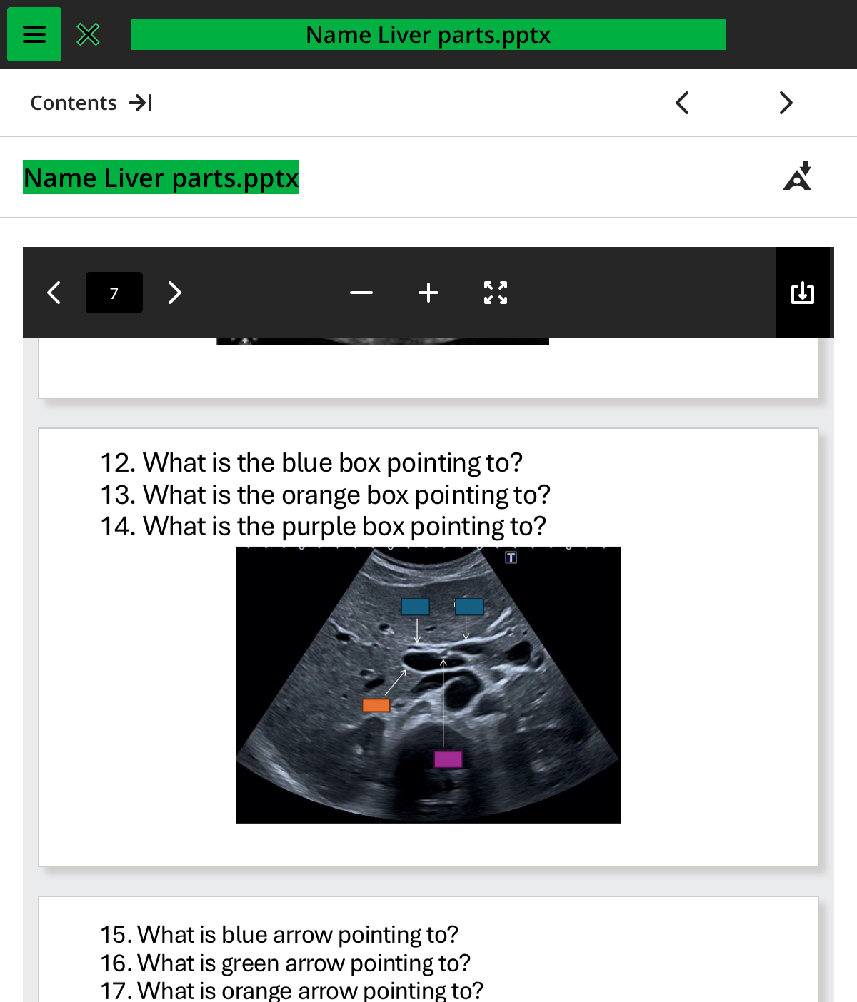 <ol start="14"><li><p>what is the purple box pointing to </p></li></ol>