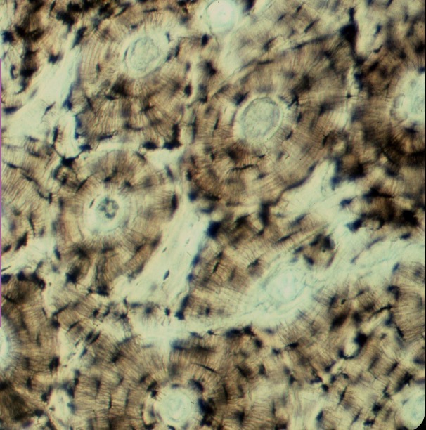 <p>Osteoplasto lagunas óseas </p>