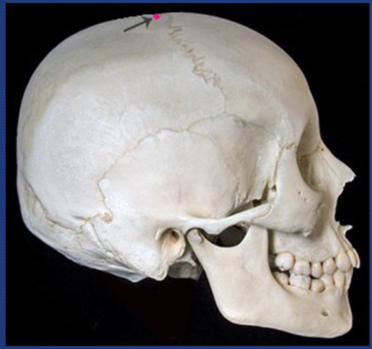 <p>The highest part of the cranium</p>