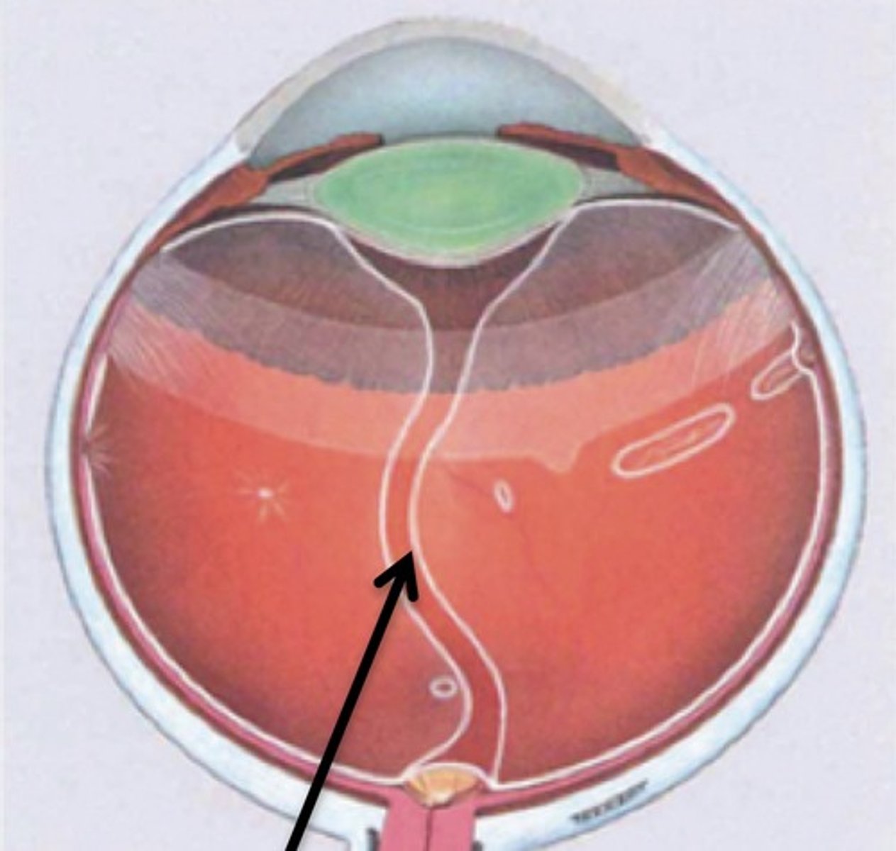 <p>-Remnant of embryonic hyaloid artery</p><p>-1–2 mm wide central channel</p><p>-Surrounded by secondary vitreous</p><p>-Ends at Area of Martegiani near optic nerve</p>