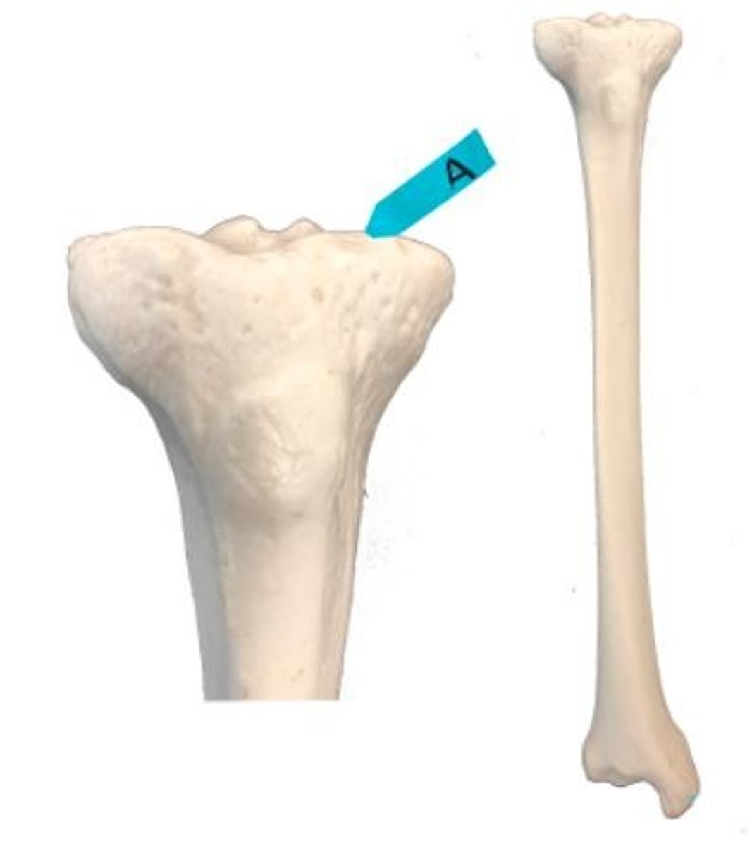 <p>Identify this bone marking.</p>