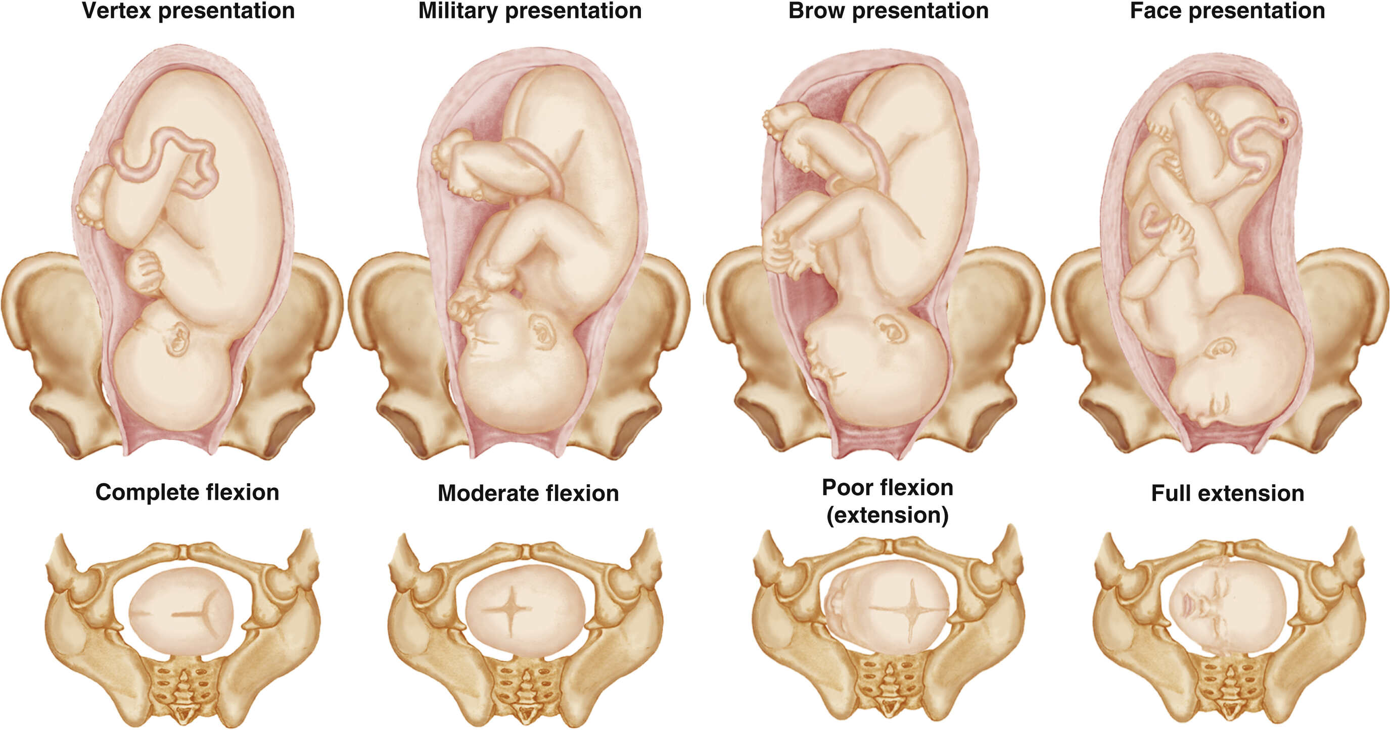 <p>vertex, military, brow, and face</p>