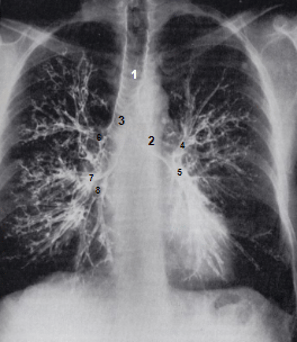 <p>at what number is the right superior lobar bronchus</p>