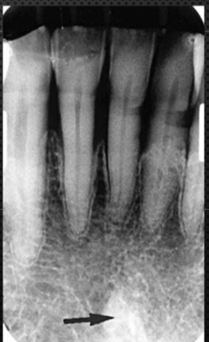 <p>Identify the radiopaque structure</p>