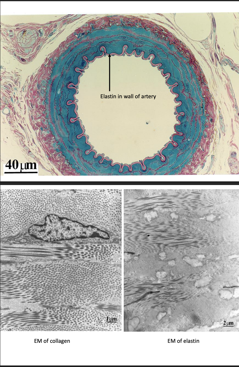 <ul><li><p>comprise a <strong>variety</strong> of cells that differ in morphology and function</p><ul><li><p>fribroblasts, adipocytes, chrondrocytes</p></li></ul></li></ul><p>What they do:</p><ul><li><p>Secrete abundance <strong>extracellular matrix</strong></p></li><li><p>provide support for other cells/tissues</p></li></ul><p>Examples</p><ul><li><p>collage</p></li><li><p> bone</p></li><li><p> elastin</p></li><li><p>adipose</p><ol><li><p>White</p><ul><li><p>unilocular, single large fat droplet per cell</p></li></ul></li><li><p>Brown</p><ul><li><p>multilocular, many small droplets per cell</p></li></ul></li></ol></li><li><p>blood </p><ol><li><p>RBC</p></li><li><p>WBC</p><ul><li><p>lymphocytes, neutrophils, monocytes, Eosinophils, Basophils</p></li></ul></li><li><p>Plateletes</p></li></ol></li><li><p>cartilage</p></li></ul><p></p>