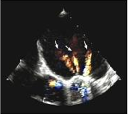 <p>3 orifices (3 color jets) </p>