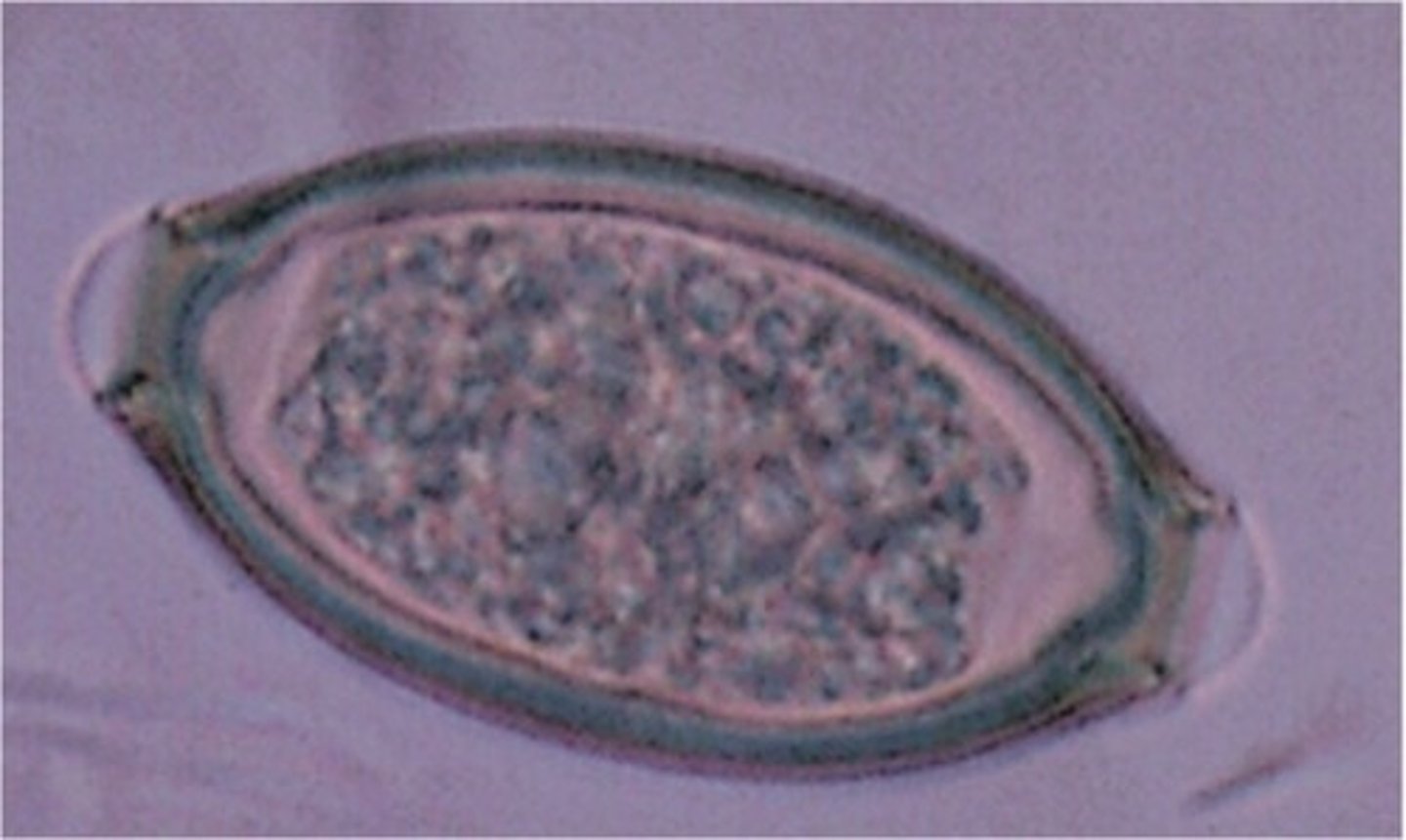 <p>Barrel shaped egg, undeveloped unicellular embryo, smooth shell surface with thick yellow-brown shell color due to bile staining, hyaline plug at each pole</p>