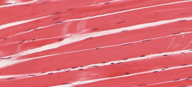 <p>Which of the following is a true statement about this muscle tissue?</p>