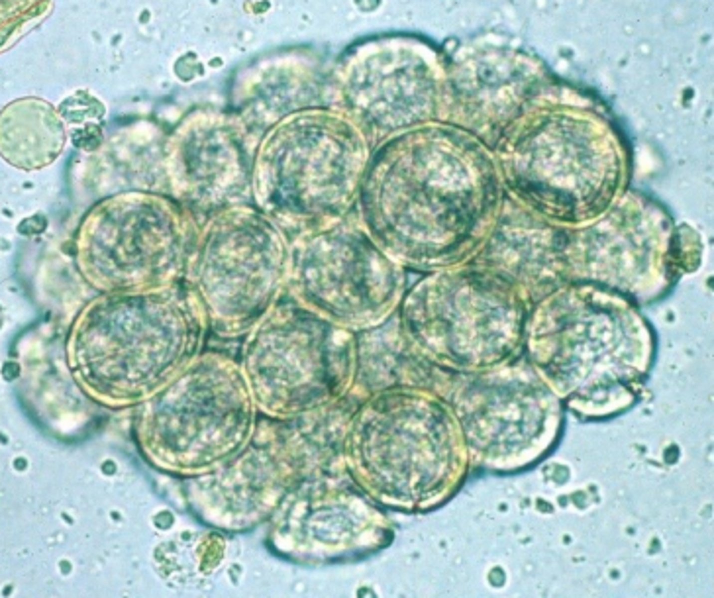 <p>These eggs were found in the fecal sample of a 10 year old Yorkshire Terrier. How was this dog infected?</p>