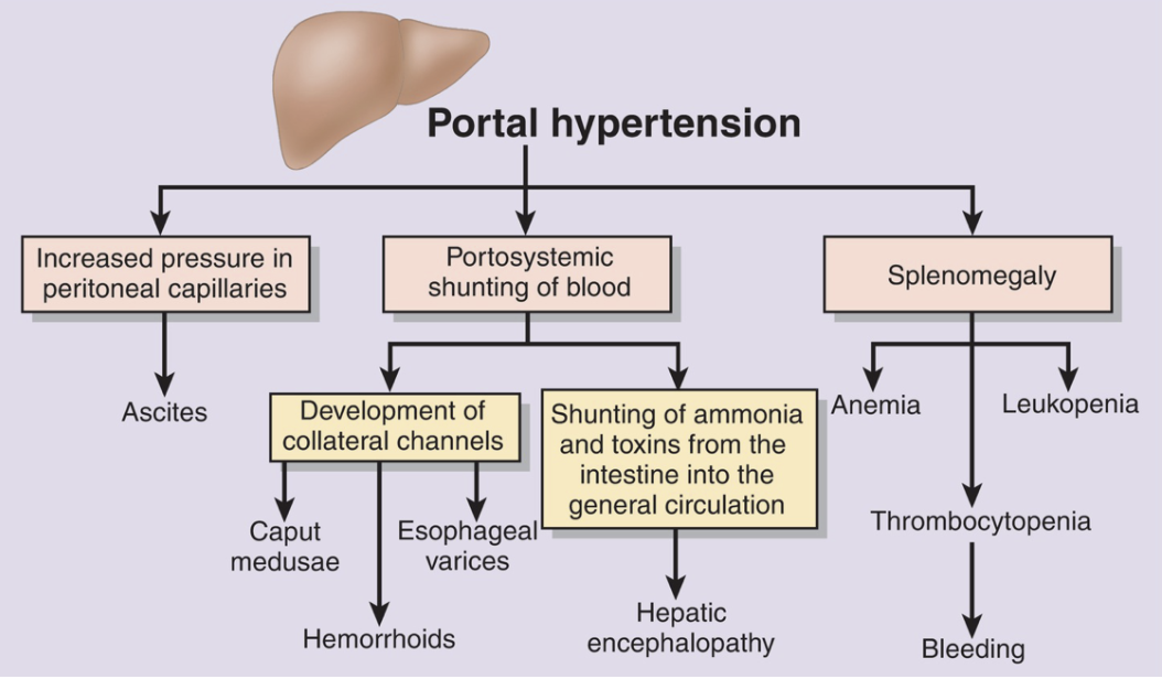 <p>increased pressure within the <span>portal venous</span> system</p><p>can cause:</p><ul><li><p><span>Ascites</span></p></li><li><p><span>Splenomegaly</span></p></li></ul>