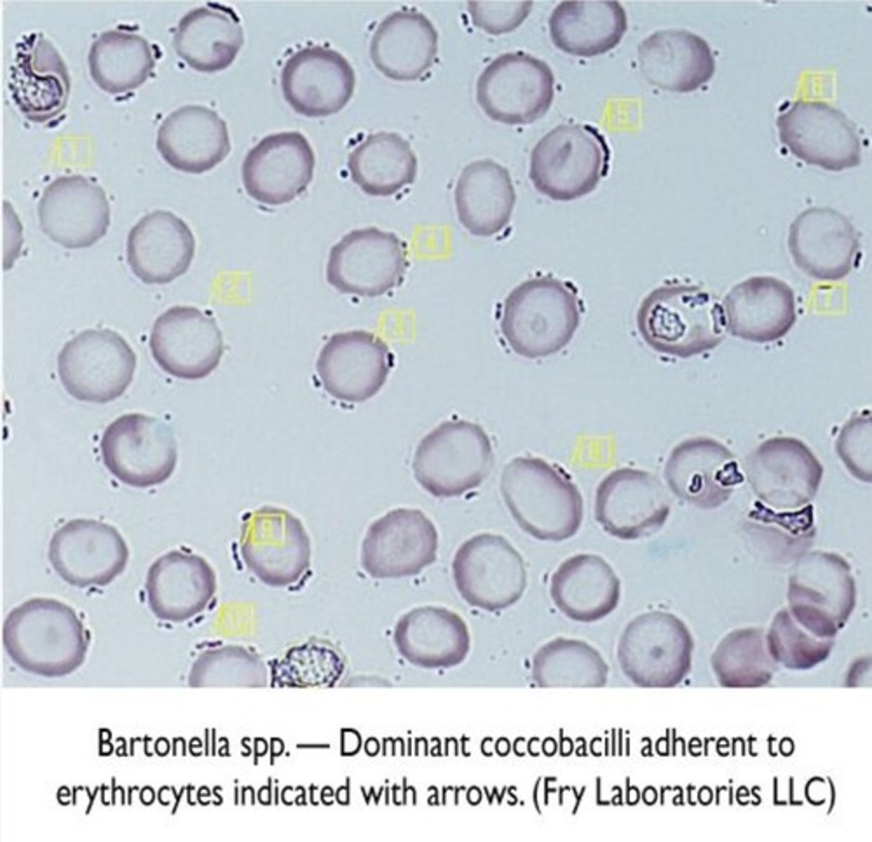 <p>Gram negative bacteria.</p><p>Facultative intracellar parasite.</p><p>It is transmitted by vectors such as ticks, flees, sand flies and mosquitoes.</p>