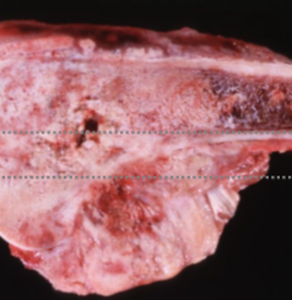 <p>Is this a benign or malignant mass?</p>