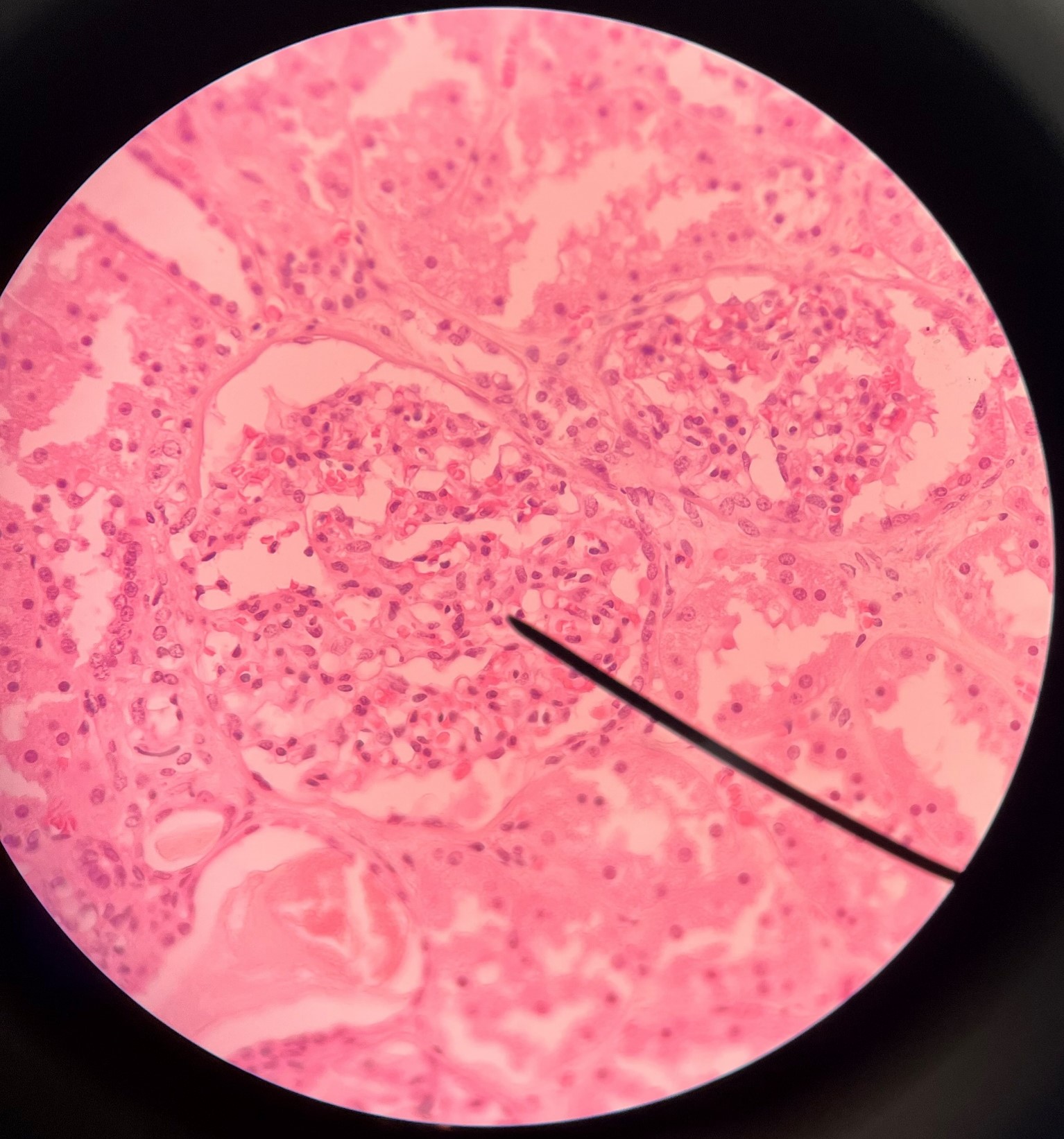 • Slide histology of the nephron.

• Part of a renal corpuscle.

• The capillary network of a renal corpuscle.