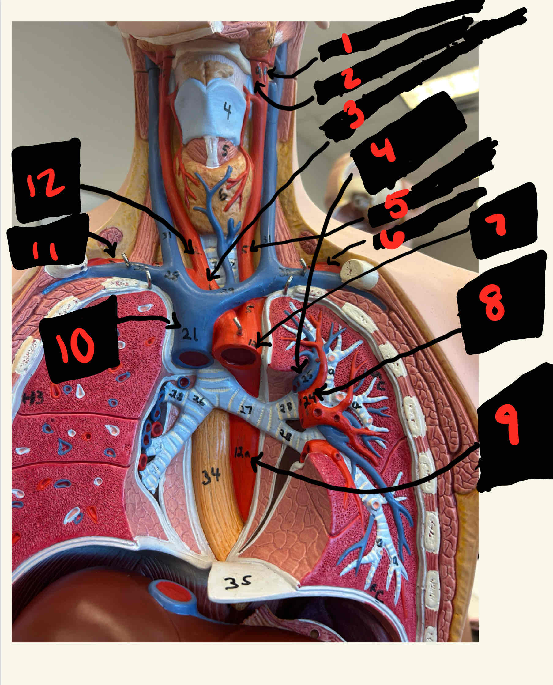 <p>What is the structure labeled 1</p>