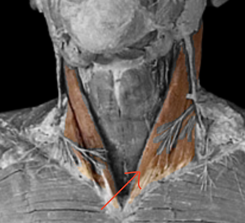 <p>What muscle is this?</p>