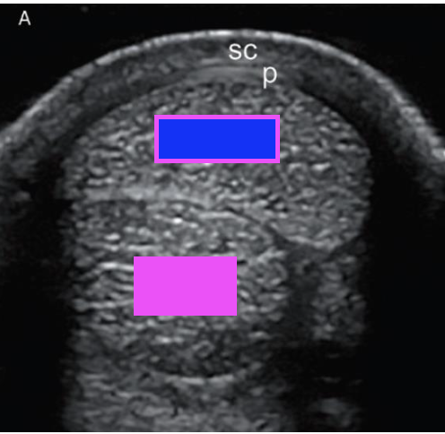 <p>what structure does the pink box indicate?</p>