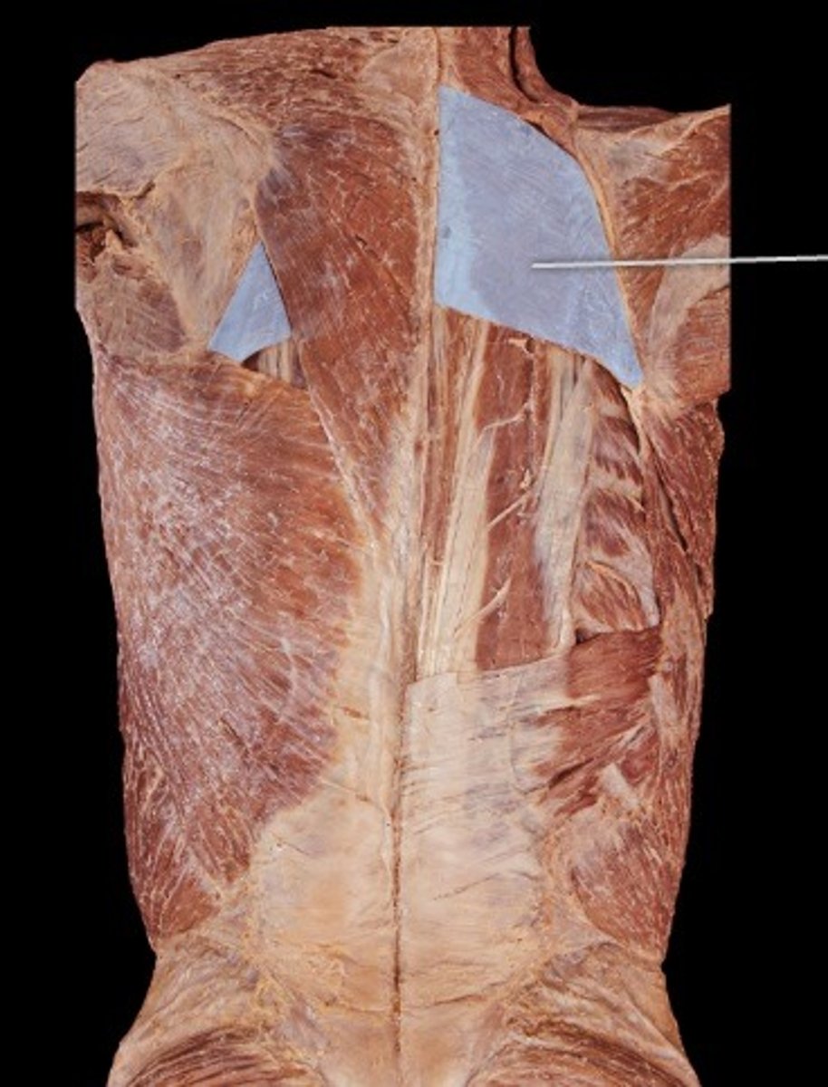 <p>What muscle is this?</p>