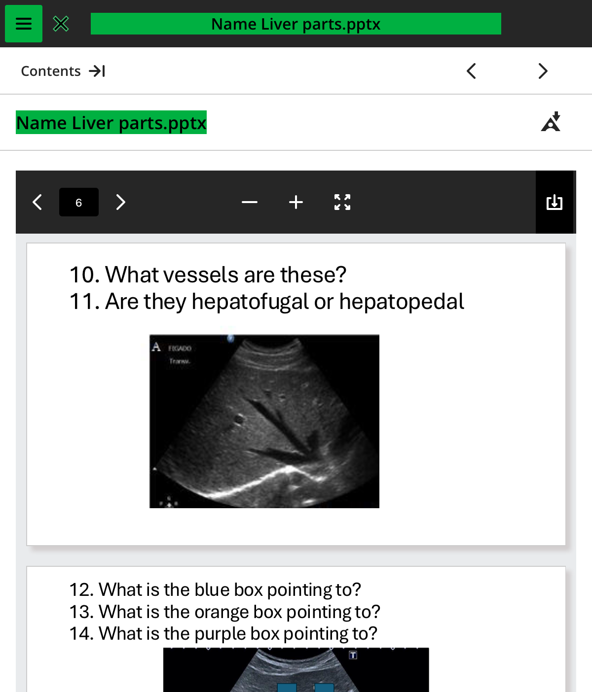 <ol start="10"><li><p>what vessels are these </p></li></ol>