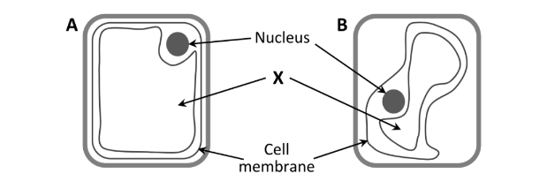 <p>Which cell is turgid?</p>