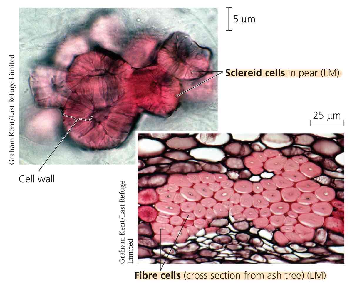 <p>Sclereids and fibres.</p>