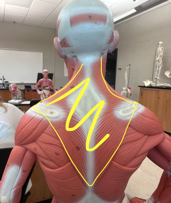 <p>What muscle is the yellow line indicating? What action does this muscle perform?</p>